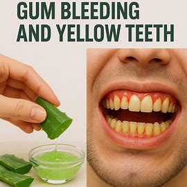The Secret Natural Solution for Gum Bleeding and Yellow Teeth!