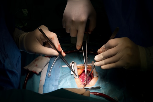 How to Select the Best Vascular Surgeon for Endovascular Procedures