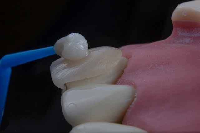 From Coffee Stains to Confidence: Glasgow’s Most Trusted Teeth Whitening Experts