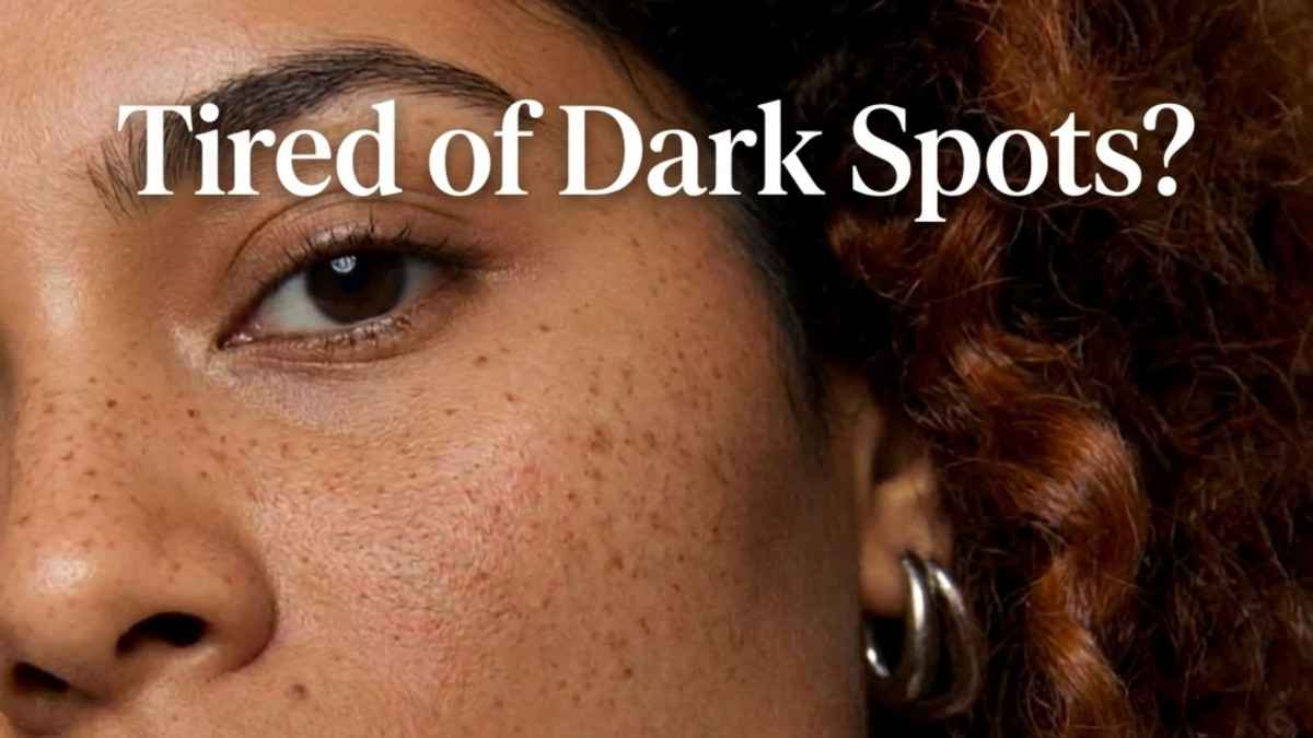 Tired of Dark Spots?