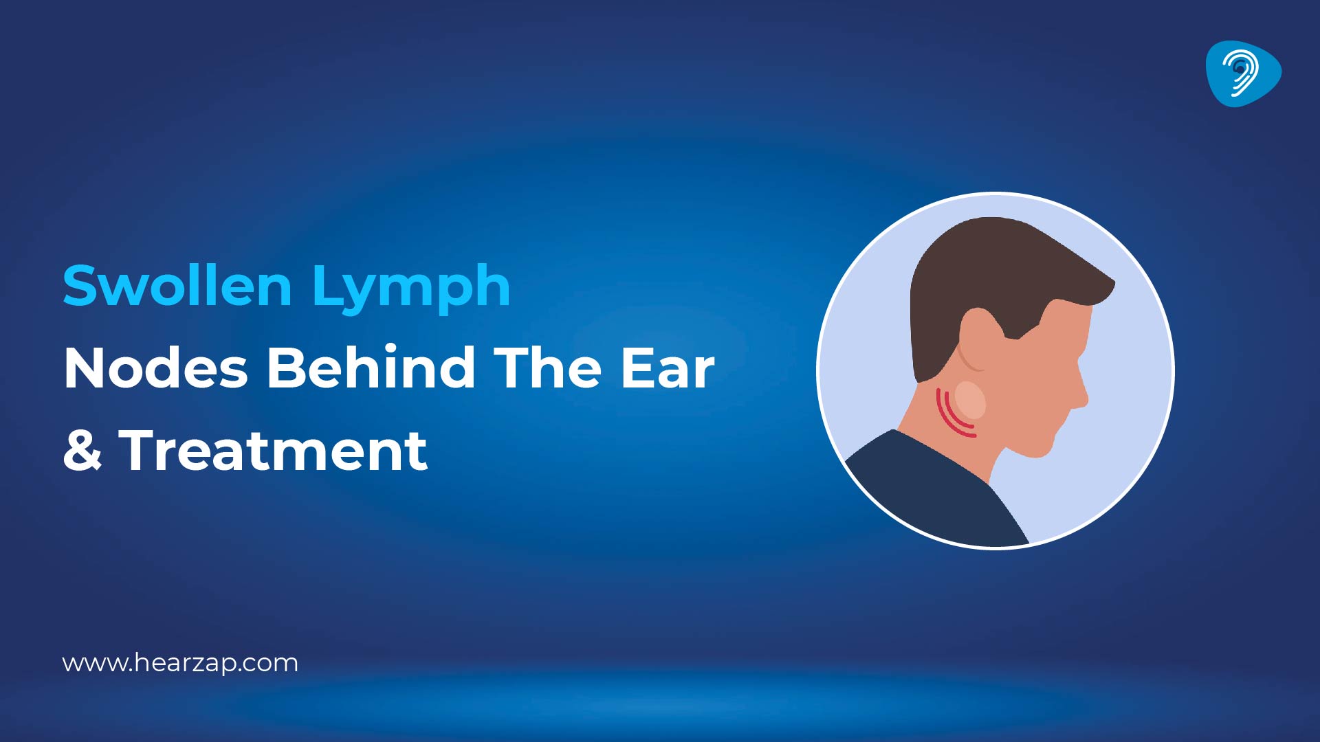 Swollen Lymph Nodes Behind the Ear: Causes, Symptoms, and Treatment