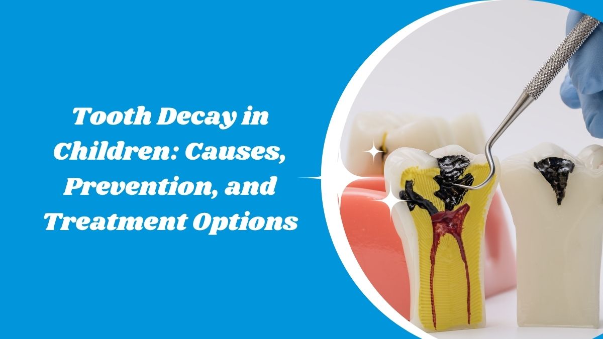 Tooth Decay in Children: Causes, Prevention, and Treatment Options