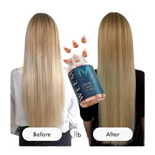 How Weem Hair Vitamins Support Healthy Hair Growth?