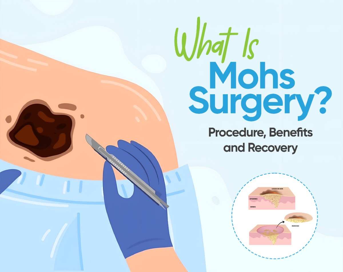 Mohs Micrographic Surgery: Procedure & Benefits