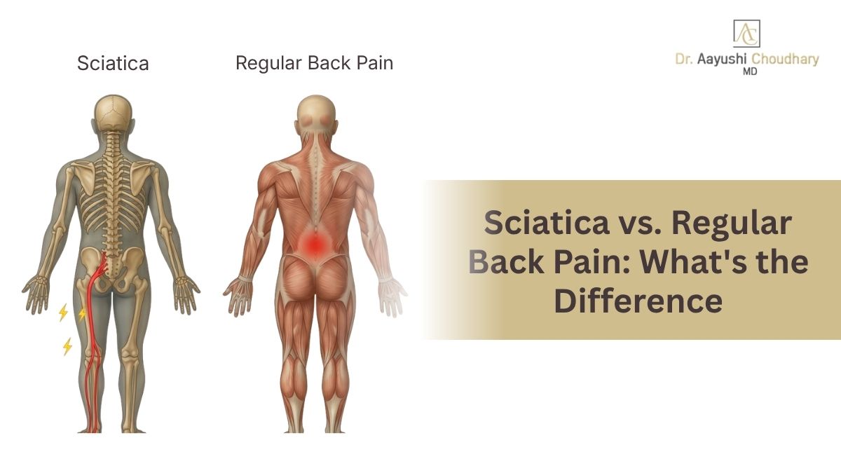 Sciatica vs. Regular Back Pain: What's the Difference? | Expert Guide