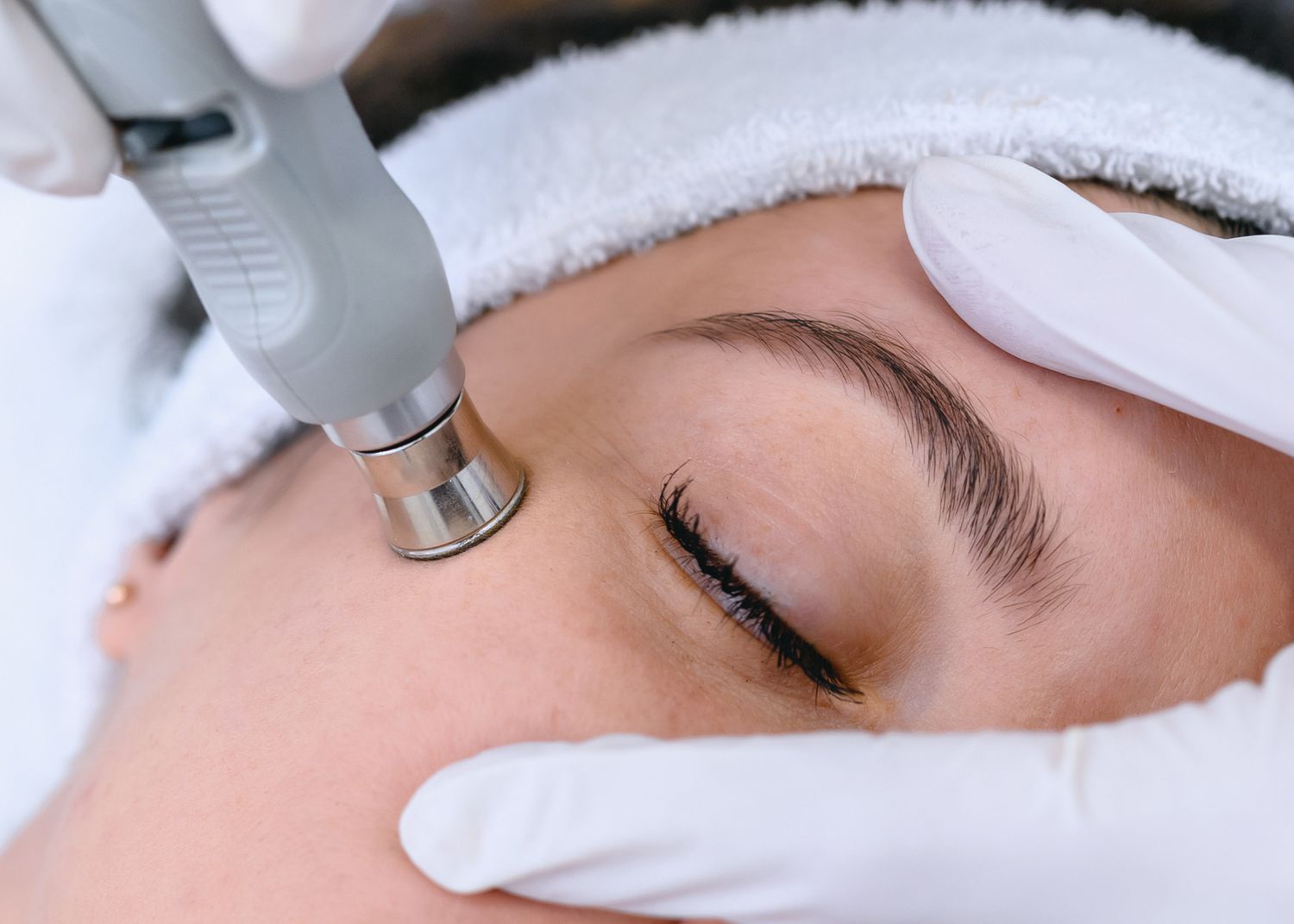 Anti Aging Treatment In Assam with Advanced Skin Rejuvenation & Modern Laser Care for Younger-Looking Skin | Essence Ski