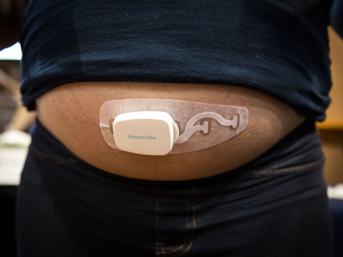 Wearable Pregnancy Devices Market Potential Across Connected Maternal Healthcare Ecosystems