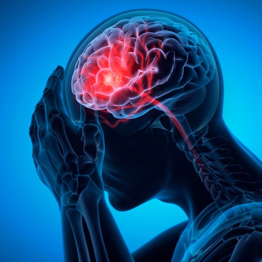 Stroke Prevention Tips Everyone Should Follow