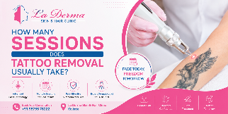 How Many Sessions Does Tattoo Removal Usually Take?