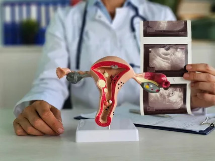 Uterine Fibroid Treatment Market Diagnostic Advancements: Precision Imaging, Digital Tools, and Smarter Clinical Assessm