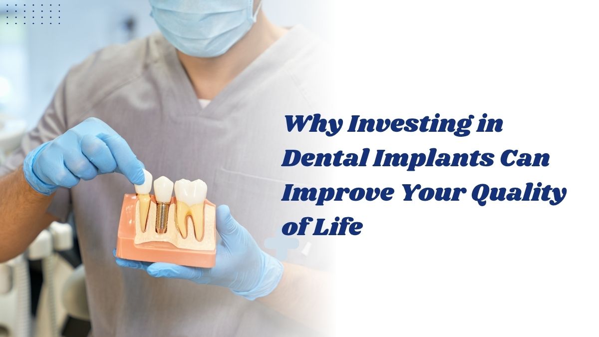 Why Investing in Dental Implants Can Improve Your Quality of Life