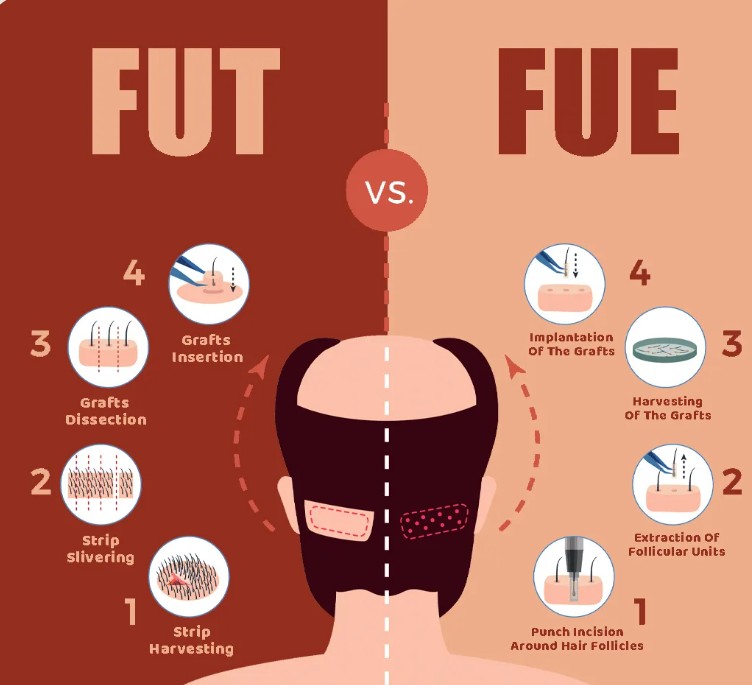 Hair Fall Causes & Treatment in Gurgaon & Delhi NCR | Aesthetics Refined by Cocoona