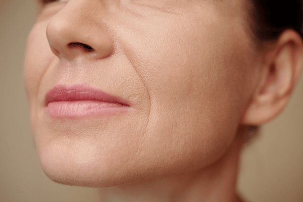 Facial Thread Lifting in Bengaluru Near Me