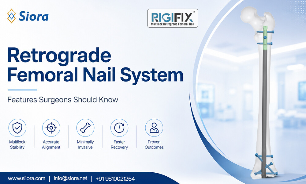 Retrograde Femoral Nail System: Features Surgeons Should Know