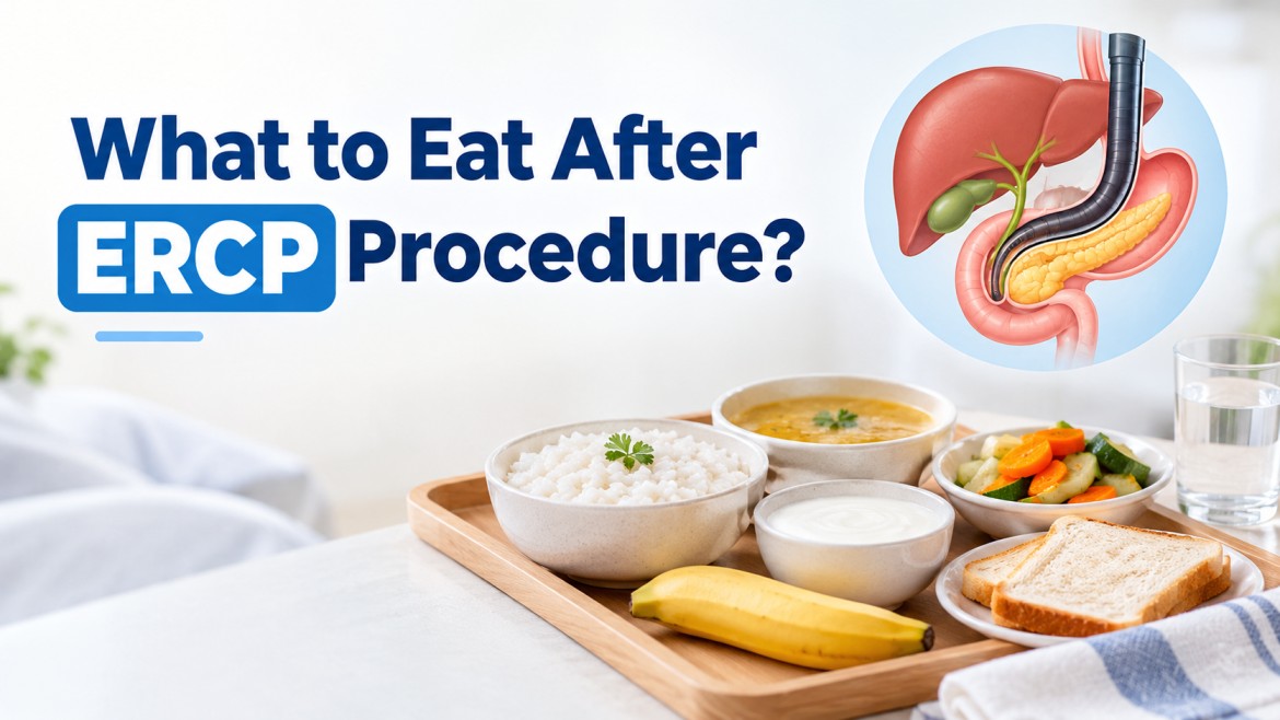 What to Eat After ERCP Procedure?