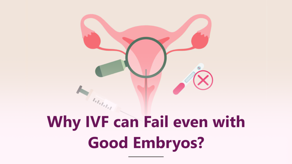 Why Does IVF Fail Even with Good Embryos?