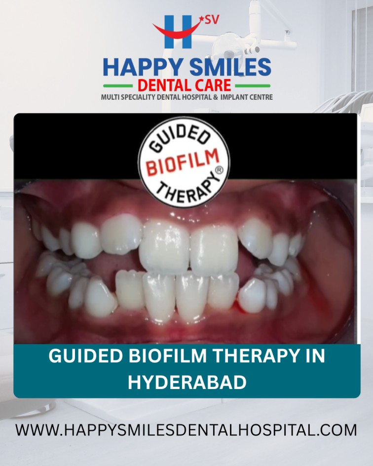 Guided Biofilm Therapy Cost in Hyderabad – GBT Dental Care 