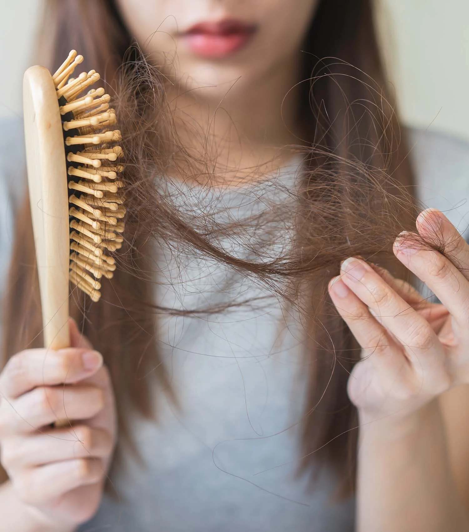 Hair Fall After Monsoon: What’s Normal, What’s Not and When to See a Doctor