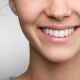 The Ultimate Guide to Teeth Whitening Services in Dubai