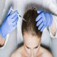 Discover the transformative power of hair transplant procedures in Dubai.