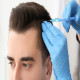 Explanation of the duration of typical procedures of Male Hair Transplant in Dubai