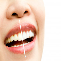 Lifestyle Smiles